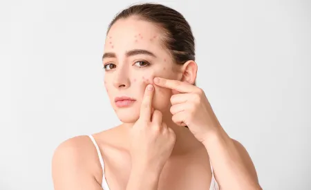 Bạn có muốn tìm một phương pháp chăm sóc da mụn tự nhiên và an toàn?