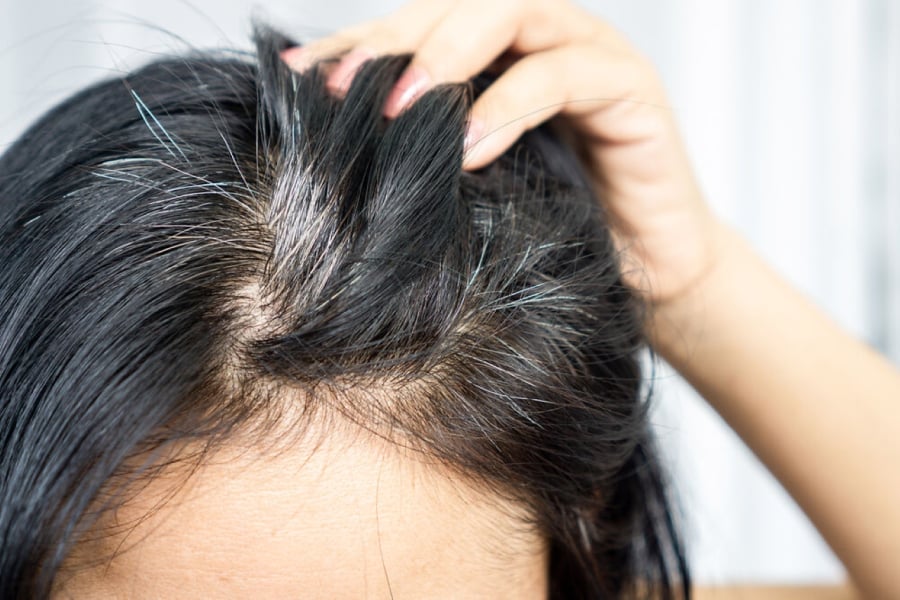 Tóc bạc do cơ thể sản xuất ra ít hắc tố hơn.