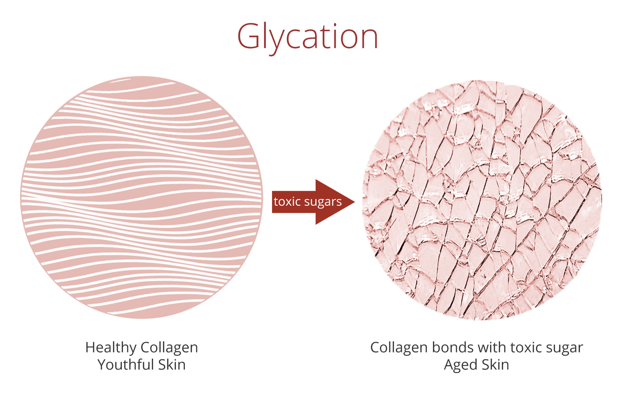 hình vòng tròn collagen bị vỡ-lão hóa