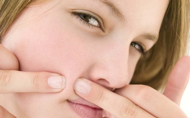 Cần được nặn đúng cách, loại bỏ hoàn toàn lõi nhân bên trong thì mới có thể khỏi hoàn toàn.