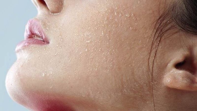 Uống đủ nước có thể giúp tăng cường quá trình hydrat hóa lớp biểu bì và các lớp da sâu hơn.