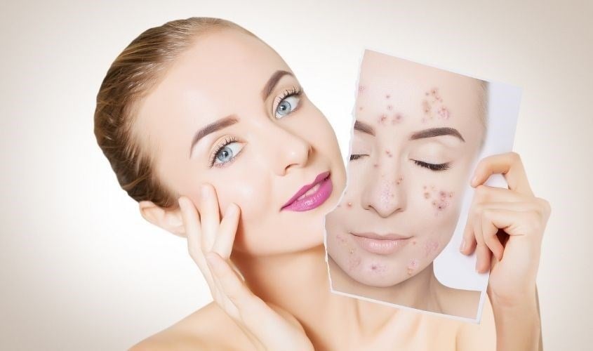 Nước muối giúp giảm ngứa, viêm da và các phản ứng dị ứng nhờ vào khả năng làm giảm các kháng thể IgE và histamin.