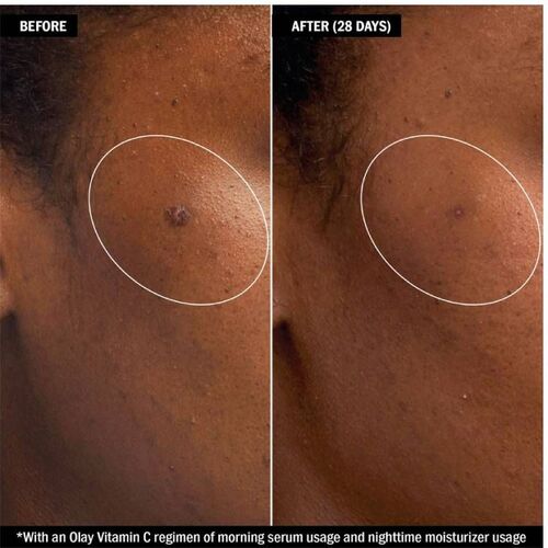 Serum trắng da mờ thâm nám Olay Vitamin C Peptide của Mỹ