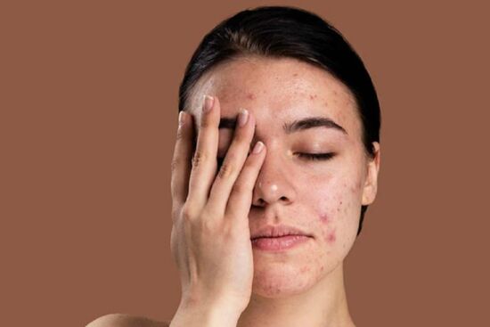 Điểm danh những thành phần cơ bản gây hại mà làn da nhạy cảm nên tránh xa