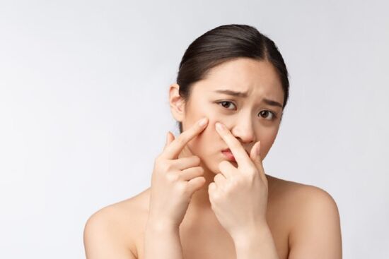 9 công thức mặt nạ đánh bay mụn và vết thâm
