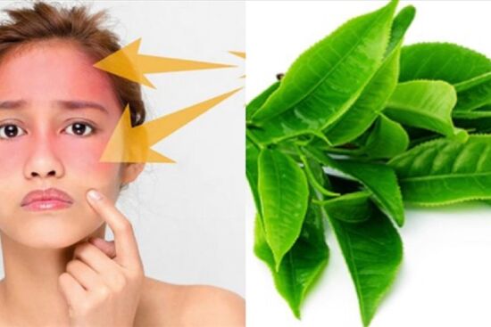 4 công thức mặt nạ trà xanh chống lão hóa, làm da sáng bật tông chỉ thời gian ngắn