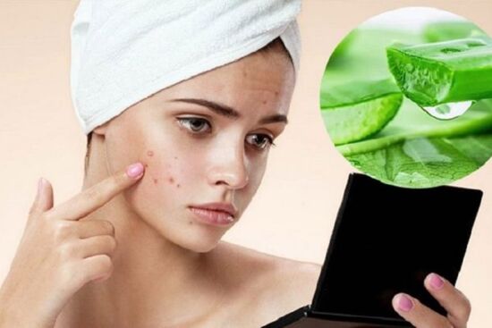 5 công thức cải lão hoàn đồng cho làn da bằng lô hội chị em nên biết
