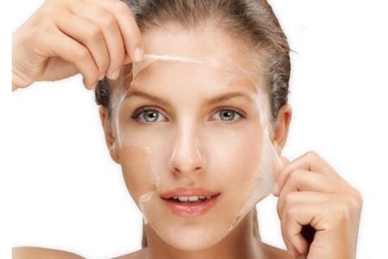 Lột da mặt để trị nám có phải là phương pháp tốt không?