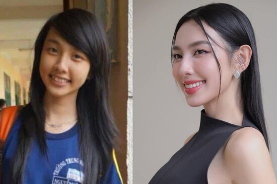 Những nàng Hậu phải tân trang một đặc điểm trên khuôn mặt để nâng tầm nhan sắc