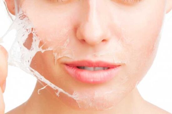 6 cách làm trị tình trạng da bong tróc, trả lại vẻ căng mịn cho làn da
