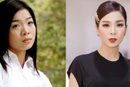Dàn mỹ nhân Vbiz tá hỏa vì gặp sự cố thẩm mỹ: Người phải tháo 'đồ giả', người chi hàng trăm triệu để sửa