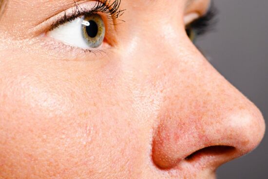 6 tips cấp cứu lỗ chân lông to và mang lại làn da mịn màng, khỏe mạnh hơn