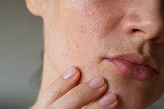 Ăn gì để có được làn da hoàn hảo dù tuổi tác dần tăng?