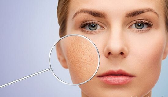 Nguyên nhân và giải pháp thu nhỏ lỗ chân lông