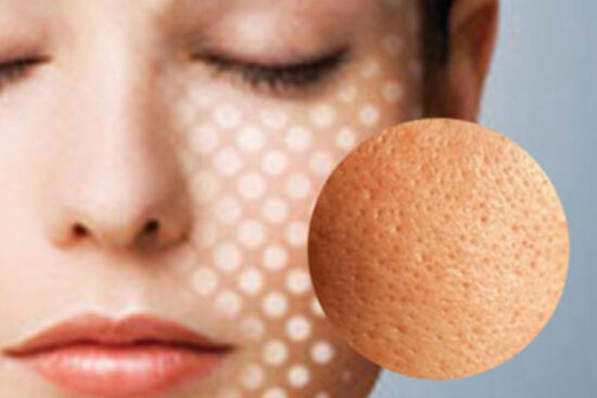 Bí kíp se khít lỗ chân lông cực kỳ hiệu quả không phải ai cũng biết