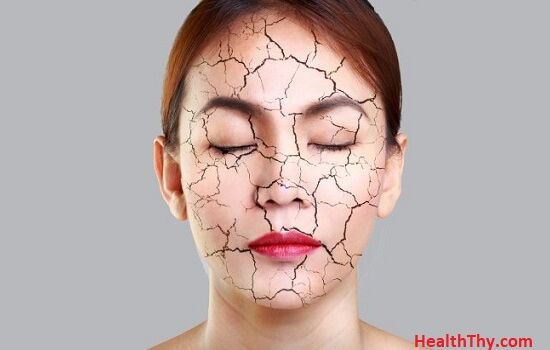 Cách hồi phục làn da khô