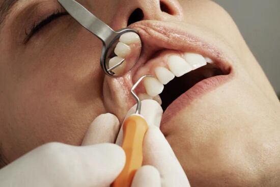 Hướng dẫn chăm sóc răng miệng đúng cách